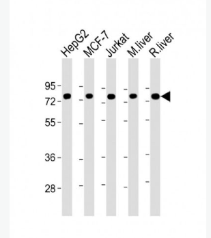 Anti-GRP78 antibody-葡萄糖调节蛋白78单克隆抗体,GRP78