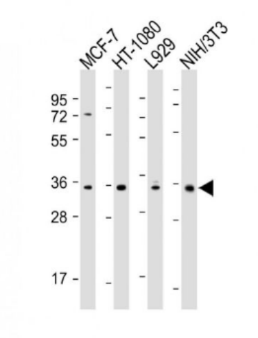 Anti-CCND1  antibody-周期素D1单克隆抗体,CCND1