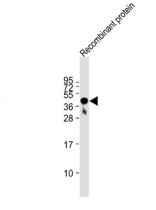 Anti-FAT4 antibody-FAT4单克隆抗体,FAT4