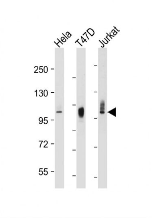 Anti-LAMP2 antibody-溶酶體相關(guān)膜蛋白2（CD107B）單克隆抗體,LAMP2