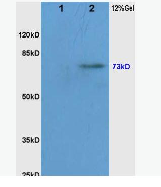 Anti-phospho-RAF1 (Ser338/Tyr340) antibody-磷酸化原癌基因RAF1抗体,phospho-RAF1 (Ser338/Tyr340)