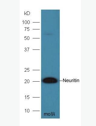 Anti-Neuritin  antibody-轉(zhuǎn)化神經(jīng)突起蛋白抗體,Neuritin