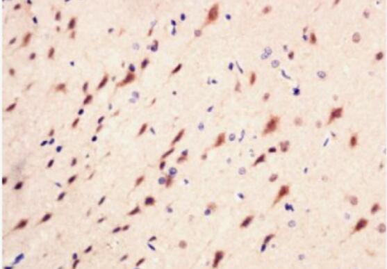 Anti-phospho-PI3 kinase p85 alpha + gamma (Tyr467 + Tyr199) antibody-磷酸化磷脂酰肌醇激酶/PI3 Kinase P85α/γ抗体,phospho-PI3 kinase p85 alpha + gamma (Tyr467 + Tyr199)