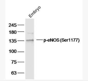 Anti-Phospho-eNOS (Ser1177) antibody-磷酸化一氧化氮合成酶3（內(nèi)皮型）抗體,Phospho-eNOS (Ser1177)