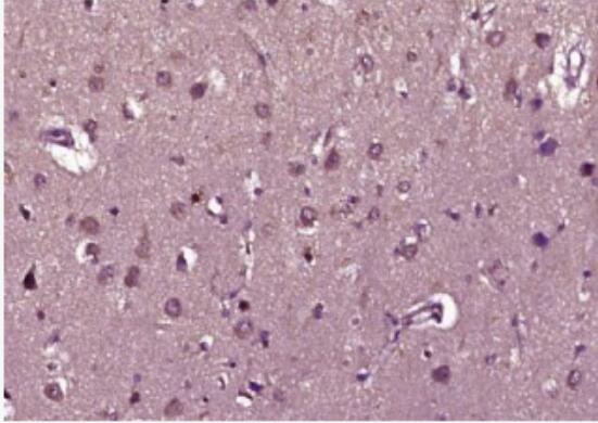 Anti-Phospho-Raptor (Ser792) antibody-磷酸化mTOR相關(guān)調(diào)控蛋白抗體,Phospho-Raptor (Ser792)