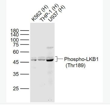 Anti-Phospho-LKB1 (Thr189) antibody-磷酸化絲氨酸/蘇氨酸蛋白激酶抗體,Phospho-LKB1 (Thr189)