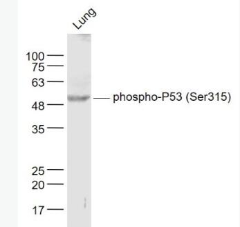 Anti-phospho-P53 (Ser315) antibody-磷酸化腫瘤抑制基因P53抗體,phospho-P53 (Ser315)