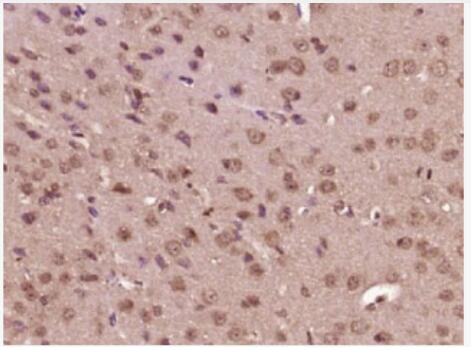 Anti-phospho-MEK1 (Thr286) antibody-磷酸化丝裂原活化蛋白激酶激酶1抗体,phospho-MEK1 (Thr286)