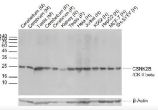 Anti-CSNK2B/CK II betaantibody-丝/苏氨酸蛋白激酶II β重组兔单抗,CSNK2B/CK II beta