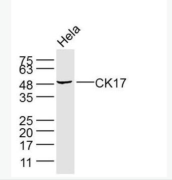 Anti-CK17 antibody-细胞角蛋白17单克隆抗体,CK17