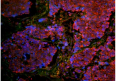 Anti-CD8B antibody-CD8β鏈（CD8-β）抗體,CD8B