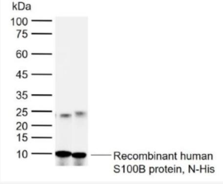 Anti-S100B antibody-人S100B蛋白多克隆抗体,S100B