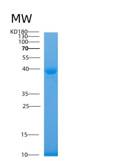 Recombinant Human TAU Protein,Recombinant Human TAU Protein