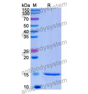 抗 Human MAGEB1 纳米抗体 (SAA1034)(RHE42702),Anti-Human MAGEB1 Nanobody (SAA1034)