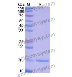 抗 Human MAGEB1 纳米抗体 (SAA1250)(RHE42703),Anti-Human MAGEB1 Nanobody (SAA1250)