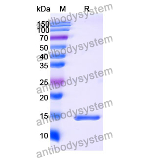 抗 Human TNFa/TNF-alpha 納米抗體 (SAA1201)(RHB94404),Anti-Human TNFa/TNF-alpha Nanobody (SAA1201)