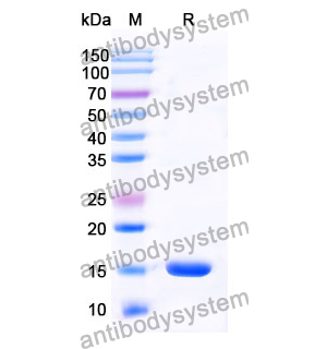 抗 Human SERPINE1/PAI-1 纳米抗体 (SAA0793)(RHC13901),Anti-Human SERPINE1/PAI-1 Nanobody (SAA0793)