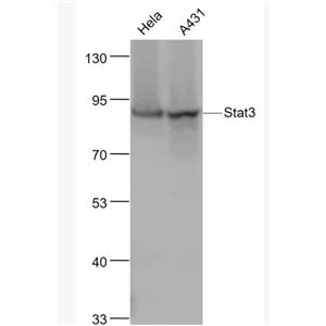 Anti-STAT3 antibody-信号转导和转录激活因子3重组兔单抗