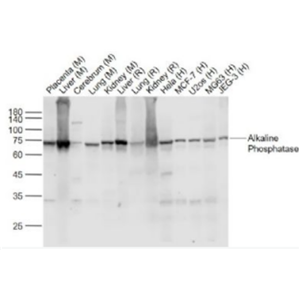 Anti-Alkaline phosphatase, tissue-nonspecific isozyme antibody-碱性磷酸酶重组兔单抗