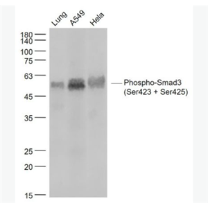 Anti-Phospho-Smad3 (Ser423 + Ser425) antibody-磷酸化细胞信号转导分子SMAD3重组兔单抗,Phospho-Smad3 (Ser423 + Ser425)