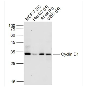 Anti-Cyclin D1 antibody-周期素D1重组兔单抗