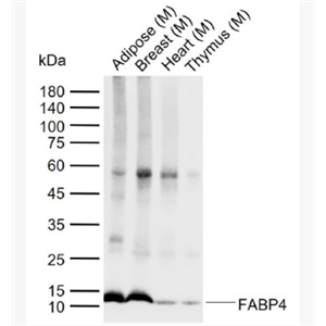 Anti-FABP4  antibody-脂肪细胞型脂肪酸结合蛋白单克隆抗体,FABP4