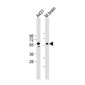 Anti-PINK1  antibody-丝氨酸/苏氨酸蛋白激酶PINK1单克隆抗体