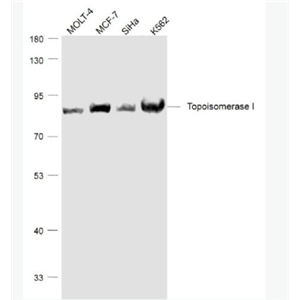 Anti-Topoisomerase I antibody-拓普西异构酶Ⅰ单克隆抗体,Topoisomerase I