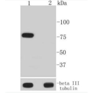 Anti-Phospho-BTK (Tyr223) antibody-磷酸化酪氨酸蛋白激酶BTK重组兔单抗,Phospho-BTK (Tyr223)