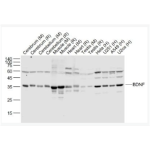 Anti-BDNF antibody-脑源神经营养因子重组兔单抗