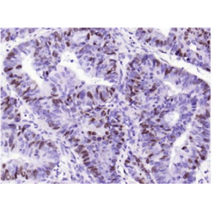 Anti-Phospho-Rb (Ser807) antibody-磷酸化视网膜母细胞瘤相关蛋白1重组兔单抗,Phospho-Rb (Ser807)