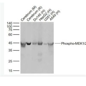 Anti-Phospho-MEK1/2 (Ser218 + Ser222)antibody-磷酸化丝裂原活化蛋白激酶激酶1/2重组兔单抗