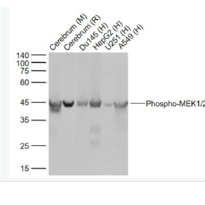 Anti-Phospho-MEK1/2 (Ser218 + Ser222)antibody-磷酸化絲裂原活化蛋白激酶激酶1/2重組兔單抗