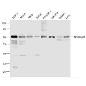 Anti-NFKB p65 antibody-细胞核因子/k基因结合核因子重组兔单抗