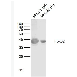 Anti-Fbx32 antibody-泛素蛋白连接酶重组兔单抗,Fbx32