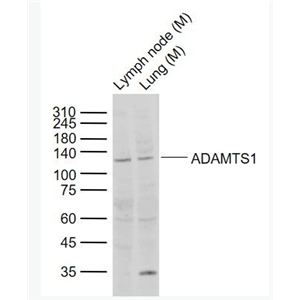 Anti-ADAMTS1  antibody-整合素样金属蛋白酶与凝血酶1型抗体