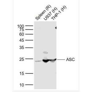 Anti-ASC/TMS1 antibody-凋亡相关斑点样蛋白ASC抗体