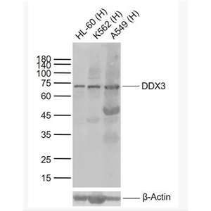 Anti-DDX3 antibody-三磷酸腺苷依赖解旋酶DDX3抗体