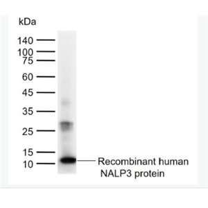 Anti-NLRP3 antibody-细胞凋亡诱导蛋白NALP3抗体