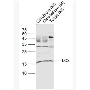 Anti-LC3 antibody-自噬微管相关蛋白轻链3抗体