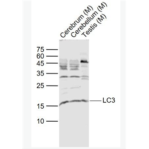 Anti-LC3 antibody-自噬微管相關(guān)蛋白輕鏈3抗體,LC3