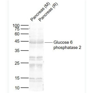 Anti-Glucose 6 phosphatase 2 antibody-胰岛葡萄糖6磷酸酶2抗体