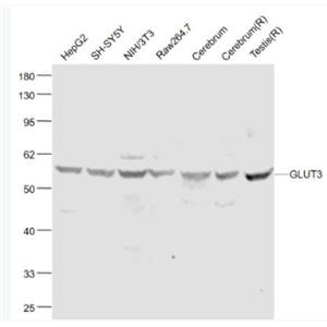 Anti-GLUT3 antibody-葡萄糖转运蛋白3抗体