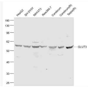 Anti-GLUT3 antibody-葡萄糖转运蛋白3抗体,GLUT3