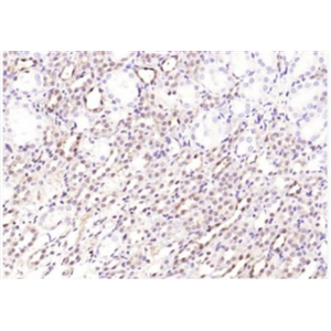 Anti-NT5C2 antibody-胞浆-5′-核苷酸酶-Ⅱ抗体