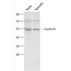 Anti-Cyclin A1 antibody-周期素A1蛋白抗体