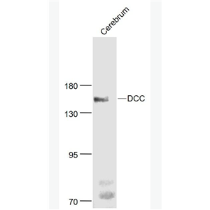 Anti-DCC antibody-结肠直肠癌缺失基因抗体