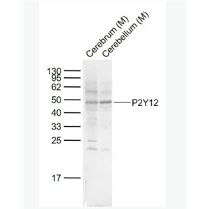 Anti-P2Y12  antibody-G蛋白偶联嘌呤受体p2y12抗体,P2Y12