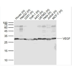 Anti-VEGF antibody-血管内皮生长因子抗体,VEGF