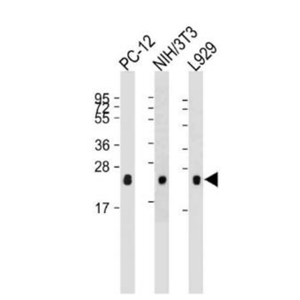 Anti-RHOA antibody-RHOA单克隆抗体,RHOA